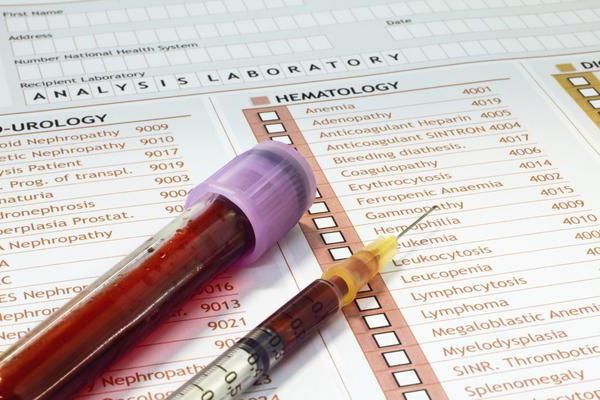 Analisi per citomegalovirus: indicazioni per la nomina di esami del sangue, che mostra la decodifica